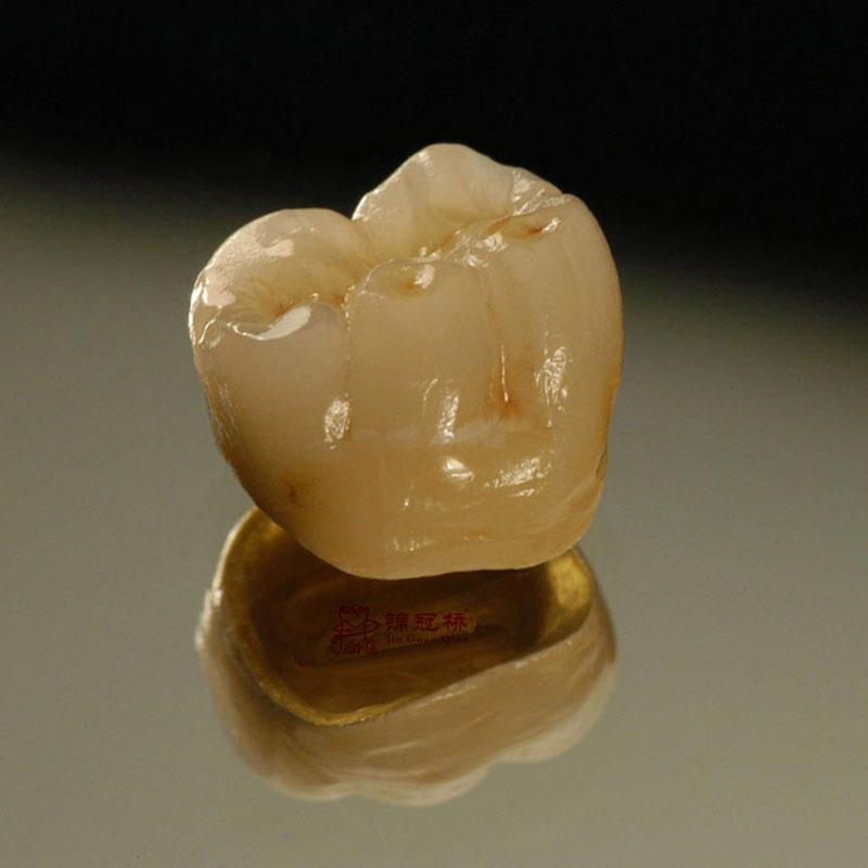 Precious metal porcelain teeth